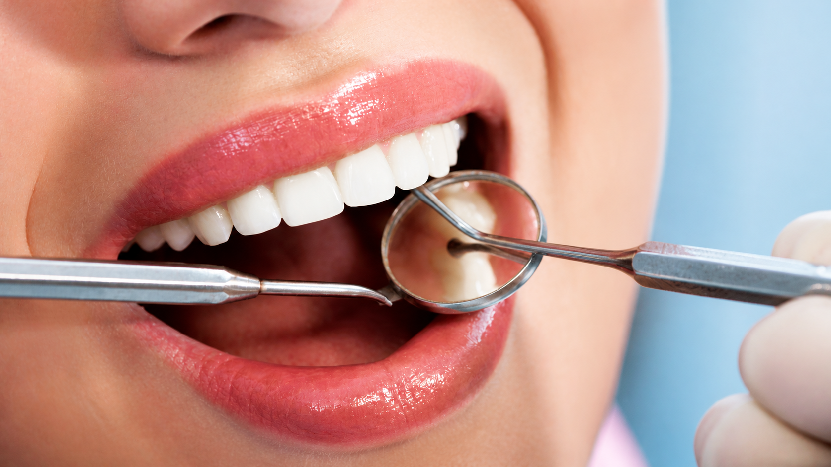 Controllo odontoiatrico ravvicinato con specchietto e sonda